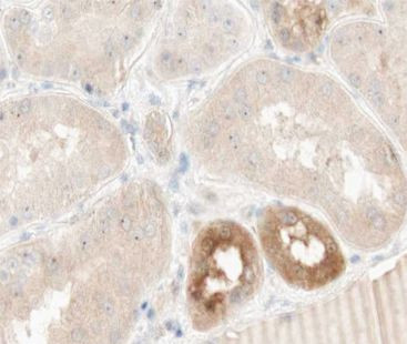 TNFAIP2 Antibody in Immunohistochemistry (Paraffin) (IHC (P))