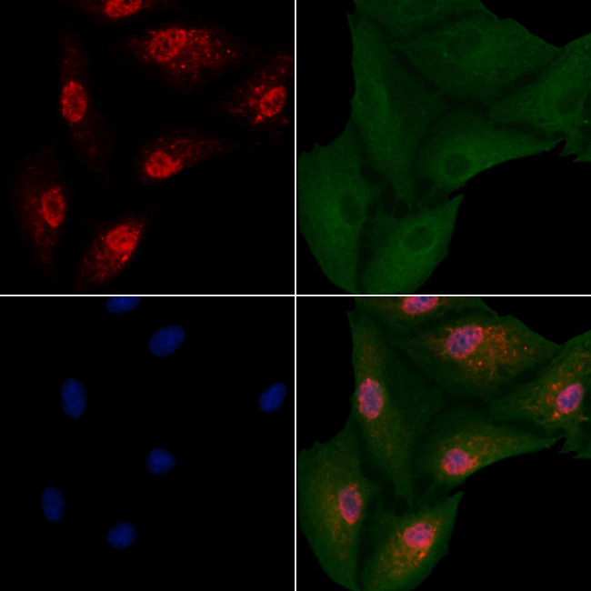 NeuroD2 Antibody in Immunocytochemistry (ICC/IF)