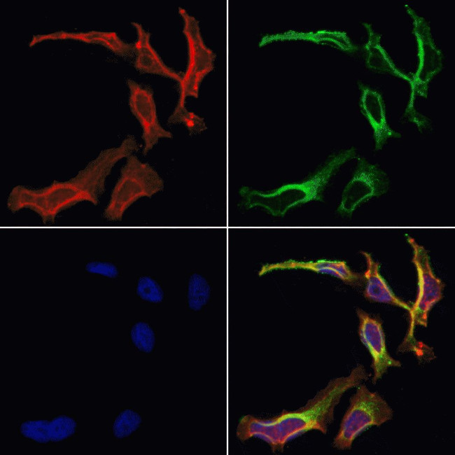 AKAP2 Antibody in Immunocytochemistry (ICC/IF)