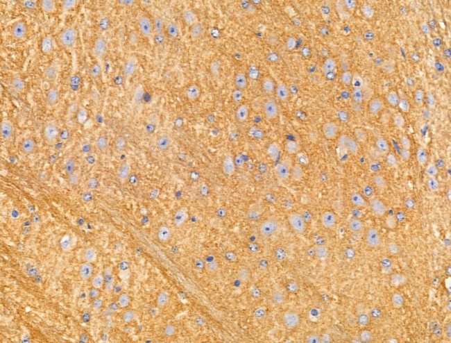 RNF144A Antibody in Immunohistochemistry (Paraffin) (IHC (P))