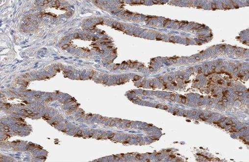 DLEC1 Antibody in Immunohistochemistry (Paraffin) (IHC (P))