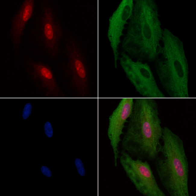 CDKL4 Antibody in Immunocytochemistry (ICC/IF)