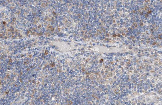 NCK2 Antibody in Immunohistochemistry (Paraffin) (IHC (P))