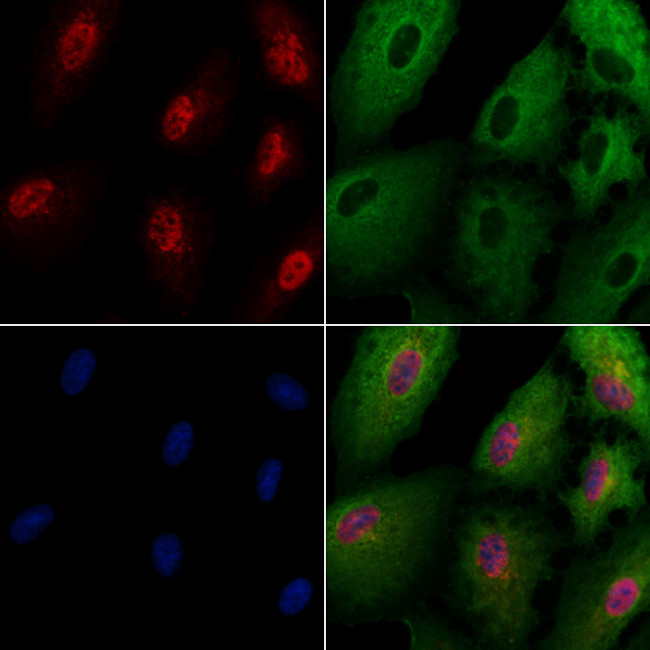 AK6 Antibody in Immunocytochemistry (ICC/IF)