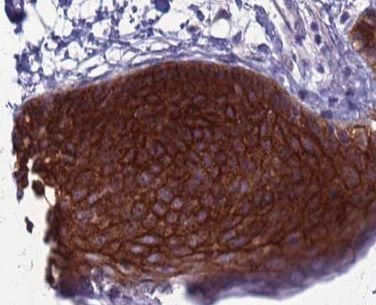 RBP5 Antibody in Immunohistochemistry (Paraffin) (IHC (P))