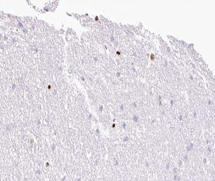 MOK Antibody in Immunohistochemistry (Paraffin) (IHC (P))
