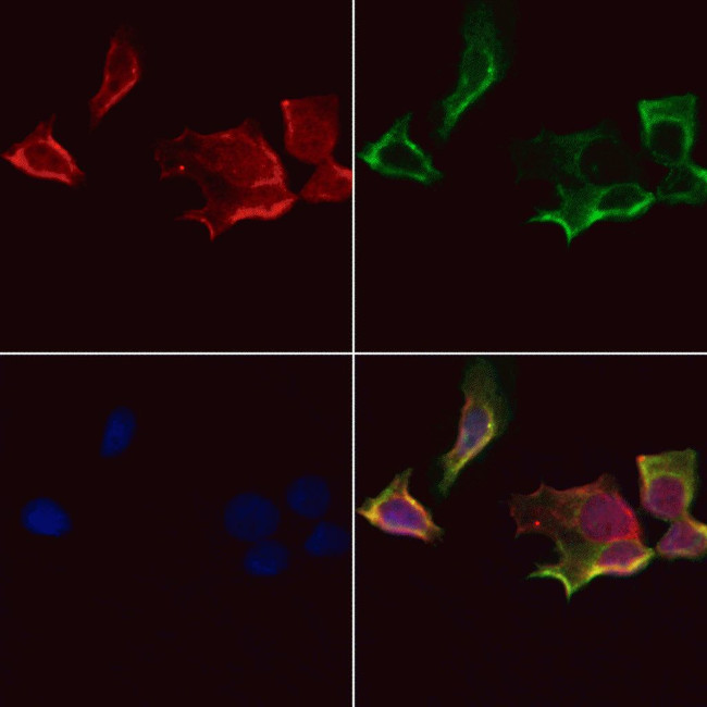 AKT Pan Antibody in Immunocytochemistry (ICC/IF)