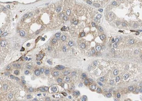 RPL31 Antibody in Immunohistochemistry (Paraffin) (IHC (P))