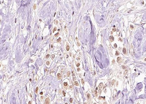 Phospho-ERK1/ERK2 (Tyr204) Antibody in Immunohistochemistry (Paraffin) (IHC (P))