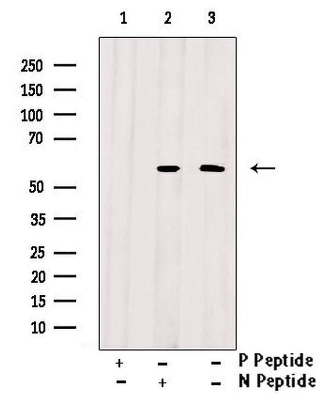 Phospho-AKT1/AKT2/AKT3 (Tyr315, Tyr316, Tyr312) Antibody in Western Blot (WB)