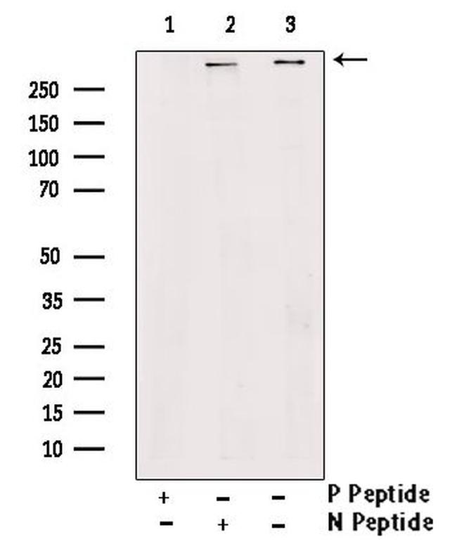 Phospho-RyR2 (Ser2814) Antibody in Western Blot (WB)