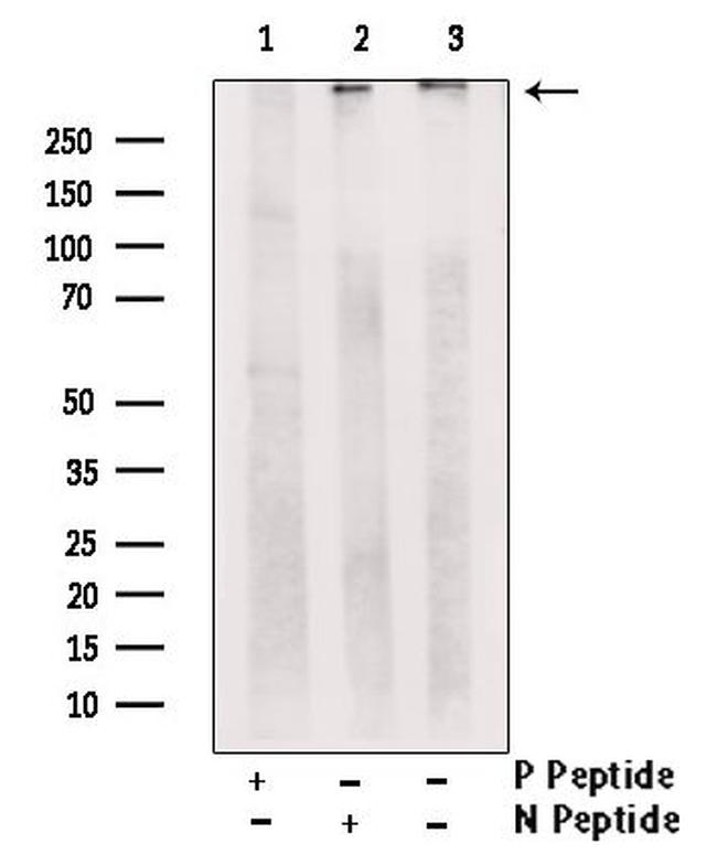 Phospho-RyR3 (Ser160) Antibody in Western Blot (WB)