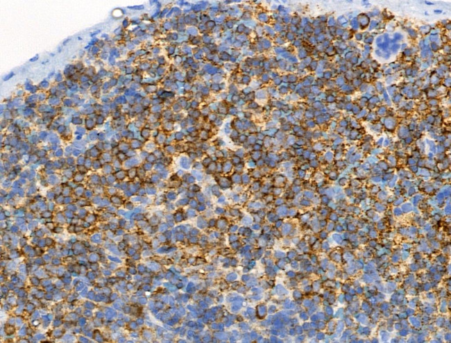 Phospho-ALK (Tyr1604) Antibody in Immunohistochemistry (Paraffin) (IHC (P))