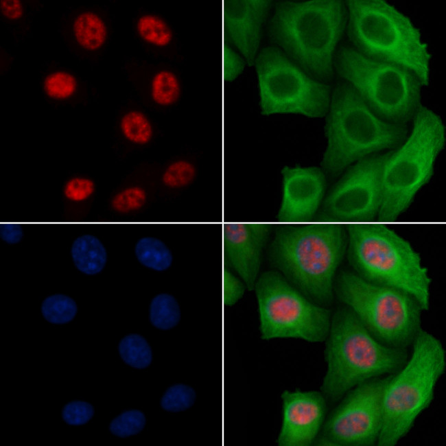 Phospho-BCL9L (Ser915) Antibody in Immunocytochemistry (ICC/IF)