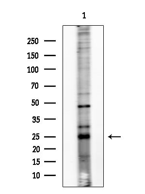 Phospho-Bim (Ser77) Antibody in Western Blot (WB)