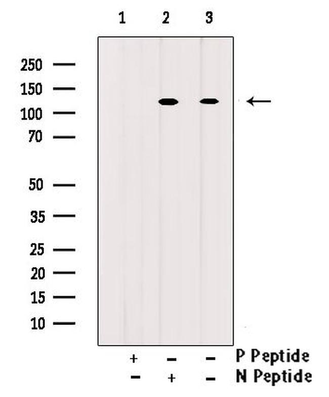 Phospho-c-Cbl (Tyr700) Antibody in Western Blot (WB)
