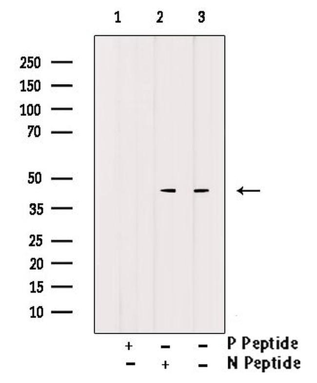 Phospho-CD79a (Tyr182) Antibody in Western Blot (WB)