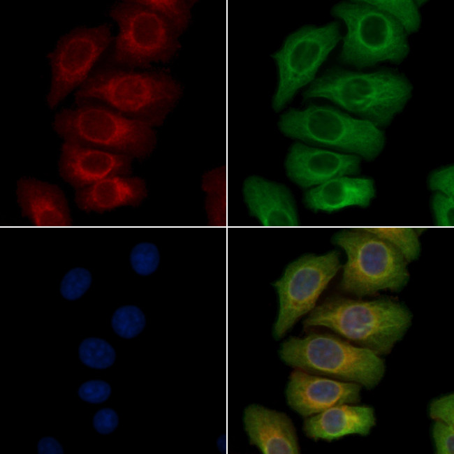 Phospho-DDR1 (Tyr513) Antibody in Immunocytochemistry (ICC/IF)