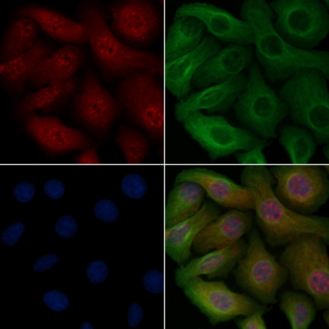 Phospho-EEF2K (Ser366) Antibody in Immunocytochemistry (ICC/IF)