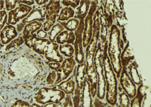 Phospho-ErbB2 (HER-2) (Tyr1221, Tyr1222) Antibody in Immunohistochemistry (Paraffin) (IHC (P))