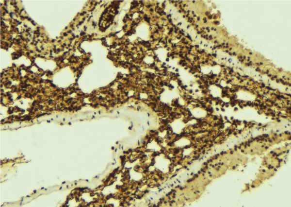 Phospho-IKK gamma (Ser376) Antibody in Immunohistochemistry (Paraffin) (IHC (P))