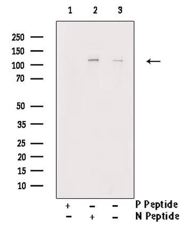 Phospho-KSR1 (Ser392) Antibody in Western Blot (WB)
