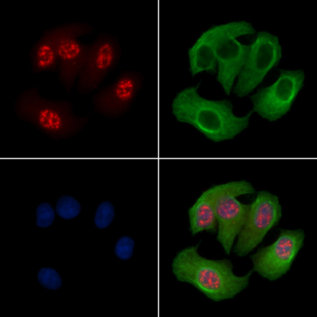 Phospho-MAPKAPK2 (Thr222) Antibody in Immunocytochemistry (ICC/IF)