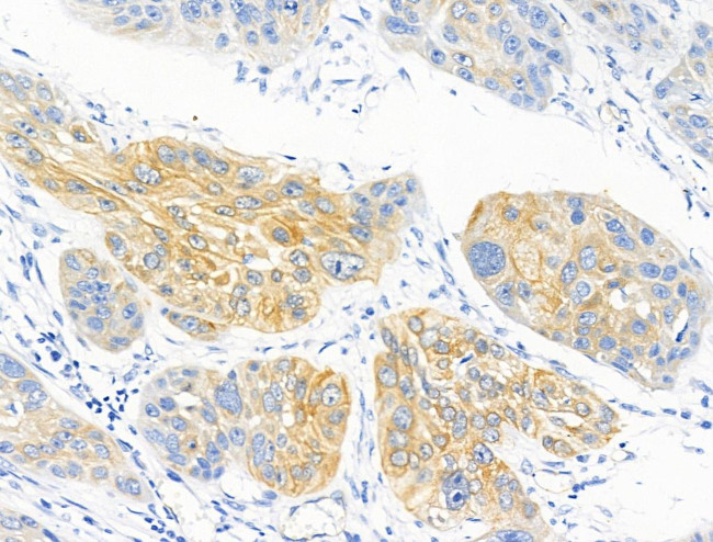 Phospho-C2orf33 (Ser172, Ser146) Antibody in Immunohistochemistry (Paraffin) (IHC (P))