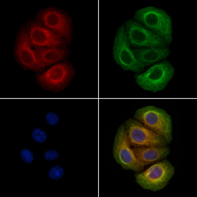 Phospho-p130Cas (Tyr249) Antibody in Immunocytochemistry (ICC/IF)