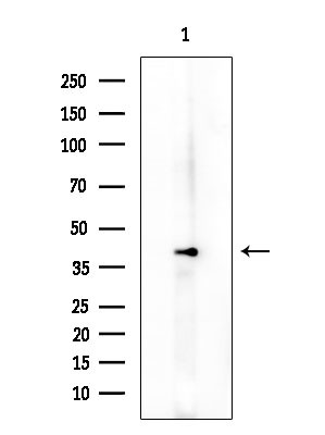 Phospho-NCF4 (Thr154) Antibody in Western Blot (WB)