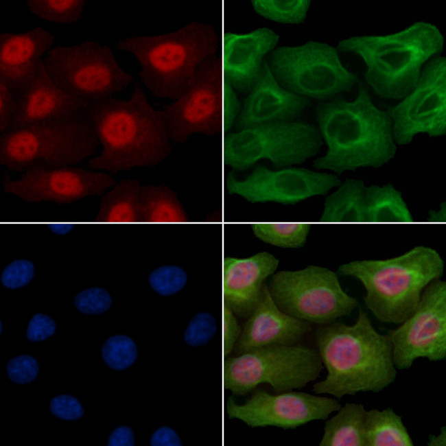 Phospho-p53 (Thr18) Antibody in Immunocytochemistry (ICC/IF)