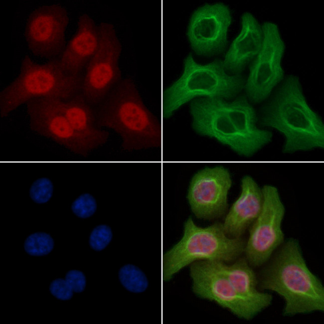 Phospho-p53 (Thr81) Antibody in Immunocytochemistry (ICC/IF)