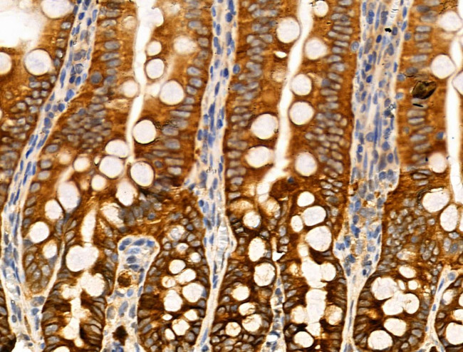 Phospho-PLCB3 (Ser1105) Antibody in Immunohistochemistry (Paraffin) (IHC (P))