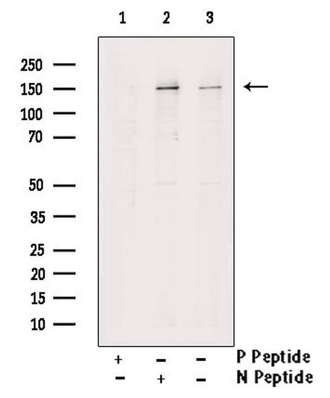 Phospho-PLCG2 (Tyr1217) Antibody in Western Blot (WB)
