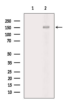 Phospho-PTPRA (Tyr798) Antibody in Western Blot (WB)