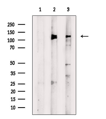 Phospho-REPS1 (Ser709) Antibody in Western Blot (WB)