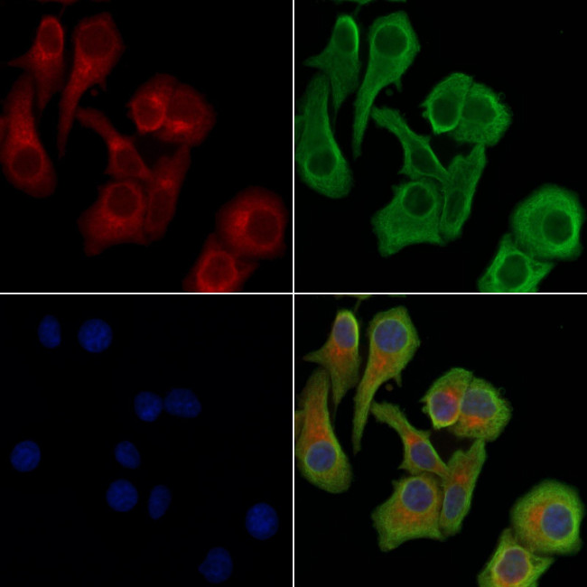 Phospho-RIP1 (Ser166) Antibody in Immunocytochemistry (ICC/IF)