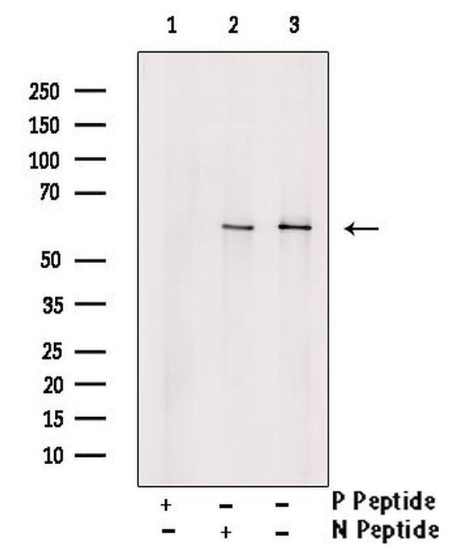 Phospho-SGK3 (Thr320) Antibody in Western Blot (WB)