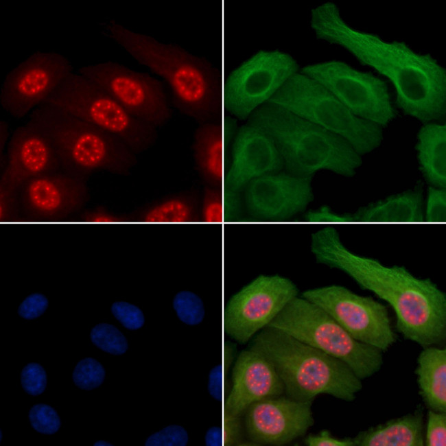 Phospho-Survivin (Thr34) Antibody in Immunocytochemistry (ICC/IF)