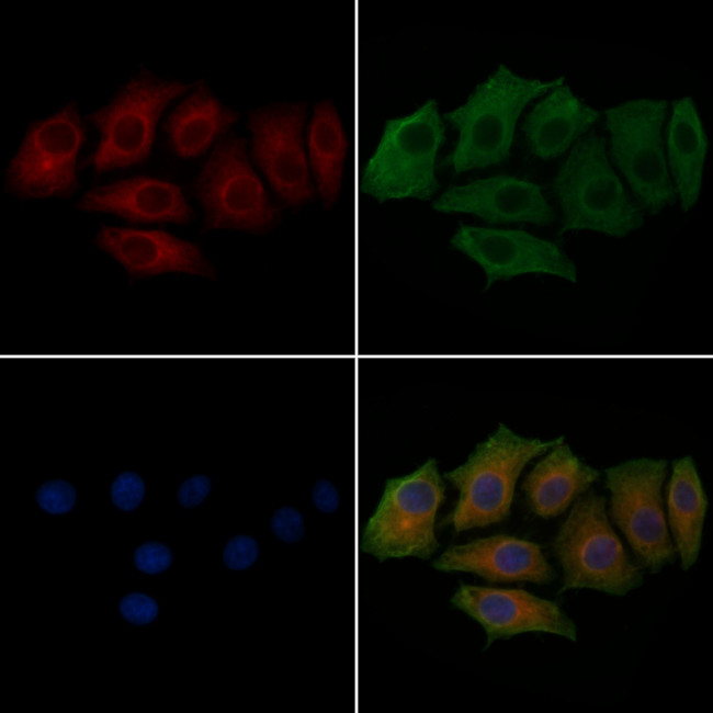 Phospho-TAK1 (Ser439) Antibody in Immunocytochemistry (ICC/IF)
