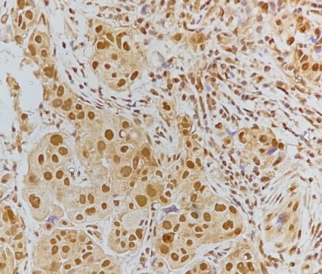 Phospho-Tau (Ser519) Antibody in Immunohistochemistry (Paraffin) (IHC (P))