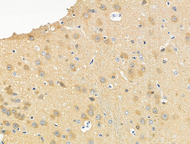 Phospho-Tau (Ser733) Antibody in Immunohistochemistry (Paraffin) (IHC (P))