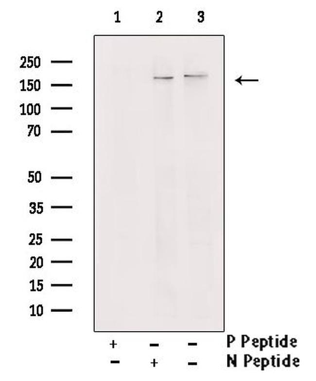 Phospho-TBC1D1 (Thr590) Antibody in Western Blot (WB)