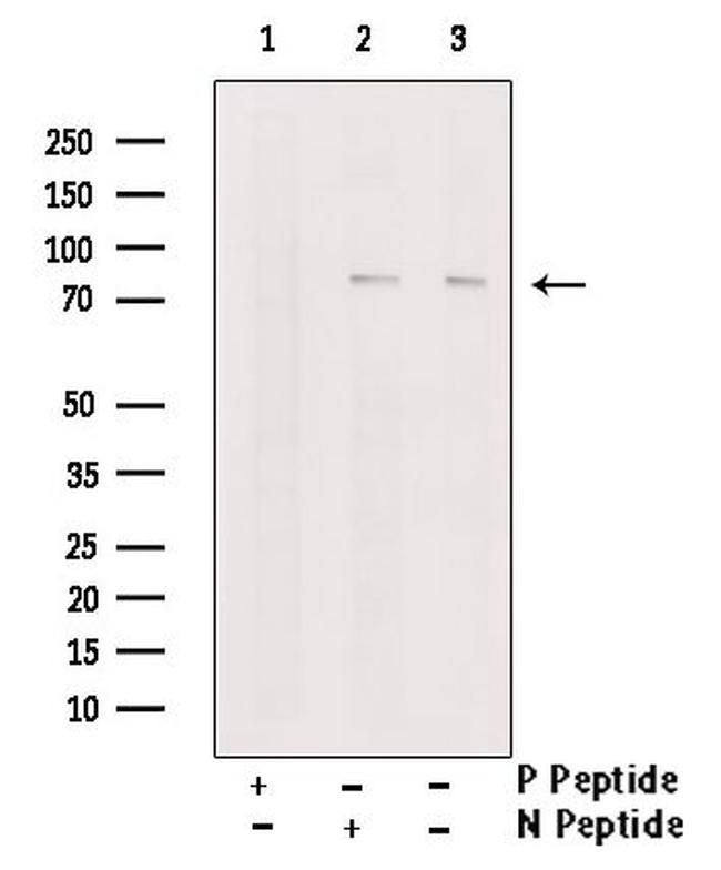 Phospho-TNK1 (Tyr277) Antibody in Western Blot (WB)