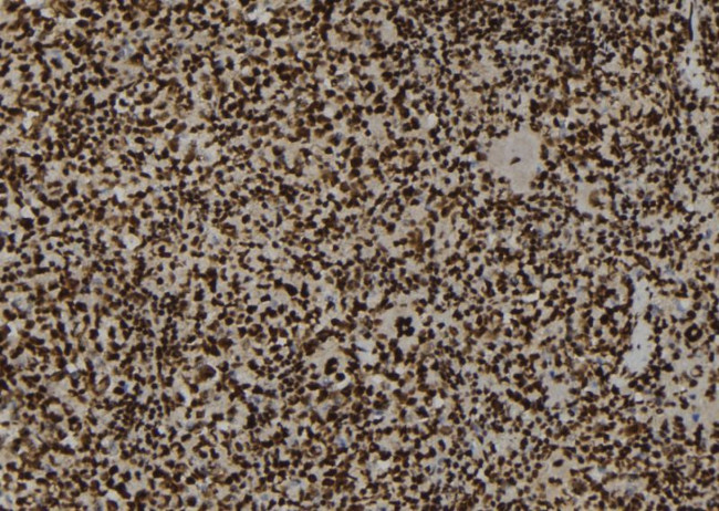 Phospho-TOP2A (Ser1469) Antibody in Immunohistochemistry (Paraffin) (IHC (P))