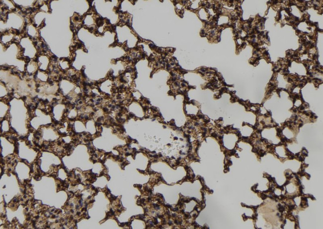 Phospho-Vimentin (Ser83) Antibody in Immunohistochemistry (Paraffin) (IHC (P))