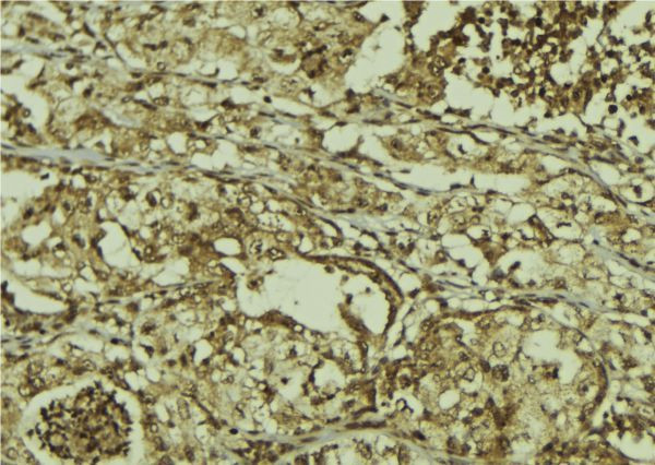 Phospho-CDK6 (Tyr13) Antibody in Immunohistochemistry (Paraffin) (IHC (P))