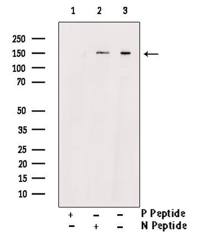 Phospho-PLCG2 (Tyr1217) Antibody in Western Blot (WB)