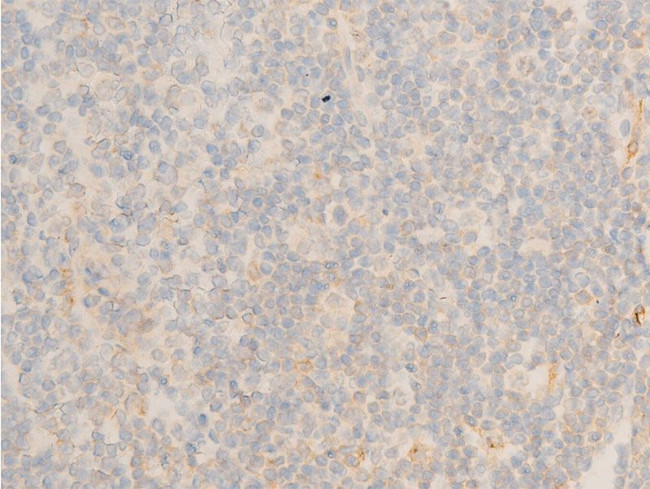 Phospho-IkappaB epsilon (Ser161) Antibody in Immunohistochemistry (Paraffin) (IHC (P))