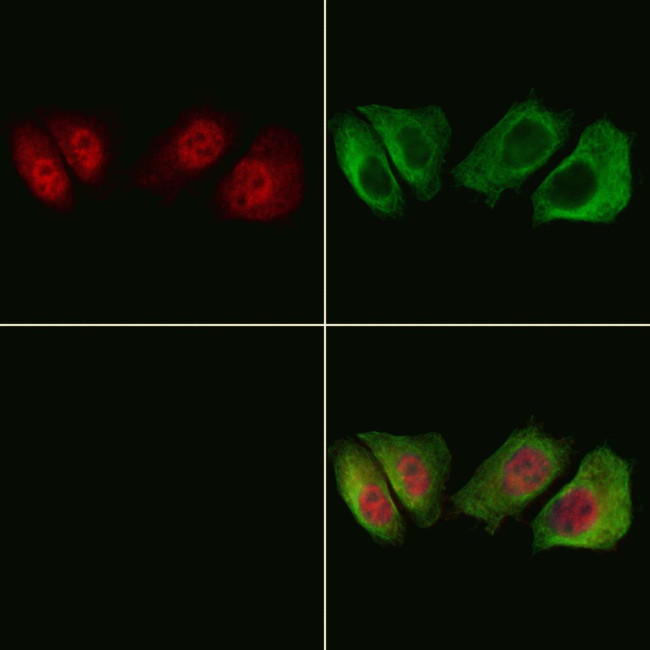 Phospho-HSP20 (Ser16) Antibody in Immunocytochemistry (ICC/IF)
